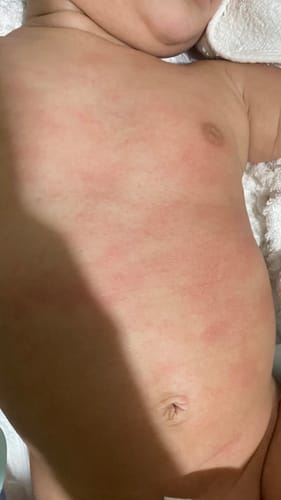 Customer photo review of Manuka Moisturising Baby Butter