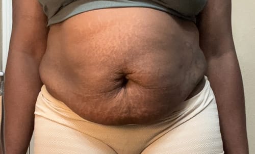 Customer photo review of "Waist NoMo" Slimming Cream