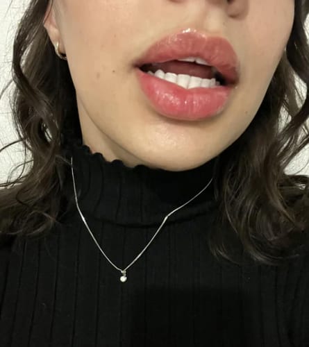 Customer photo review of Lippenfüller mit Chili & Ingwer