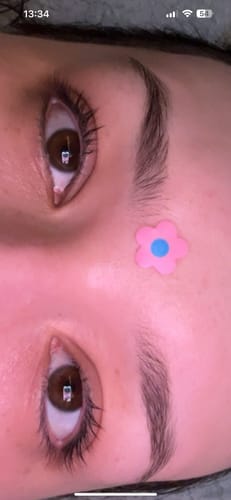 Customer photo review of Lash Growth Serum