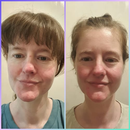 Customer photo review of Vitamin Boost Duo