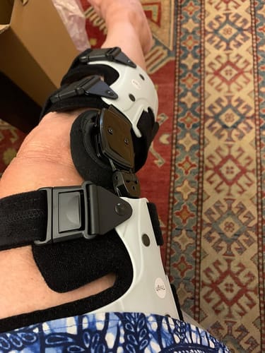 Customer photo review of TrueAlign Motion #1 Knee Brace
