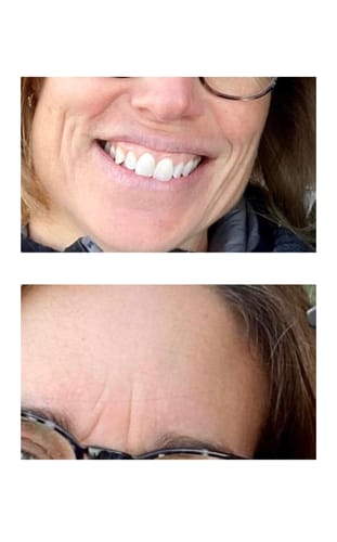 Customer photo review of Crème Hydratante Anti-Âge et Éclat (50ml)