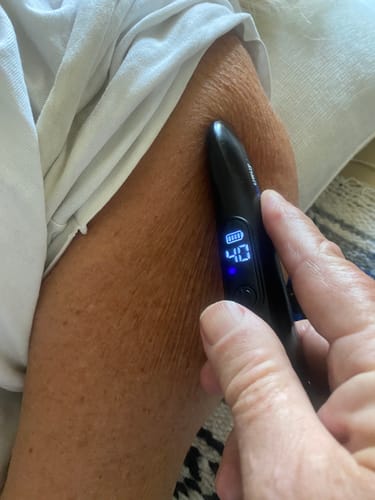 Customer photo review of Achedaway Mini Scraper:On-the-Go heated muscle scraping tool