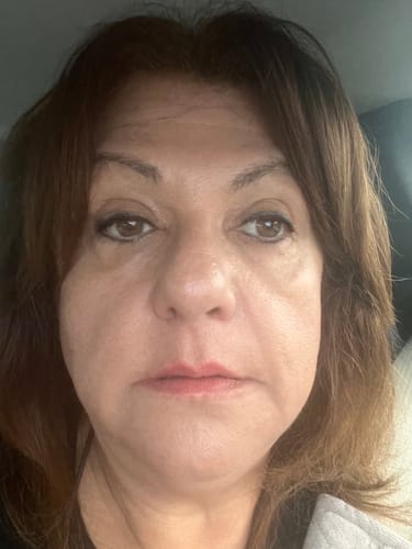 Customer photo review of Glov Micro Infusion System