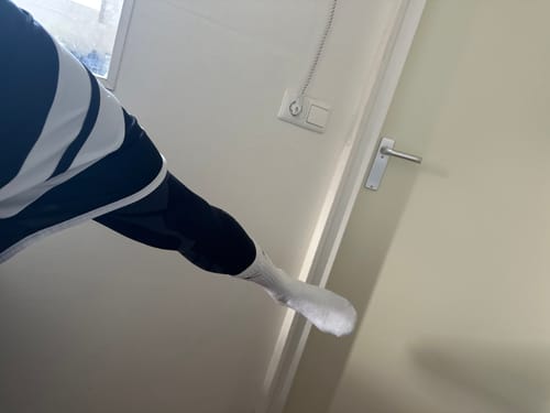 Customer photo review of Summer Compression Sleeves V2 for Knees and Legs