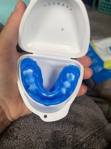 Customer photo review of All-in-One Anti-Schnarch-Schiene (Zahnschutz)