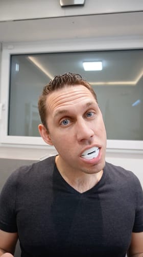 Customer photo review of All-in-One Anti-Schnarch-Schiene (Zahnschutz)