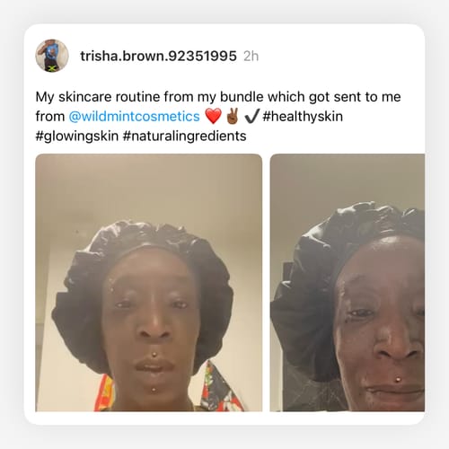 Customer photo review of 5-Step Clear Skin Kit