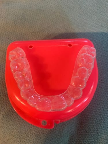 Customer photo review of REORDER-Upper Retainer