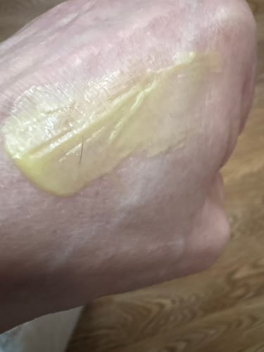 Customer photo review of THE GLIFT masque pour le Contour des Yeux
