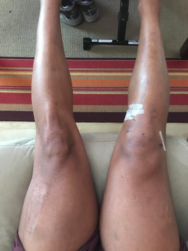 Customer photo review of Black Seed Oil & Natural Glucosamine Capsules