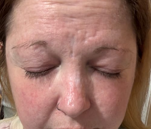 Customer photo review of EYELASH GROWTH SOLUTION