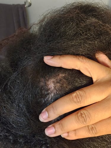 Alliyah W. review of ‼️35% off TODAY: CODE: BIGOIL35 ‼️ India’s Secret Ancient Ayurvedic Hair Follicle Elixir (5 sizes) image 2 out of 2