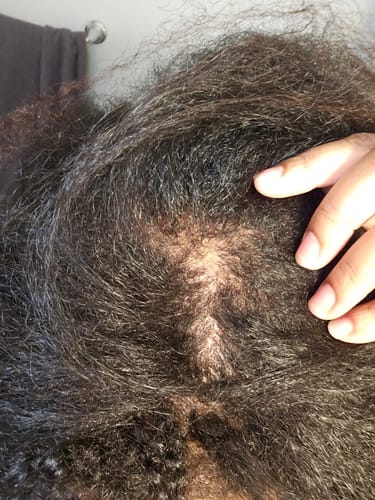 Alliyah W. review of ‼️35% off TODAY: CODE: BIGOIL35 ‼️ India’s Secret Ancient Ayurvedic Hair Follicle Elixir (5 sizes) image 1 out of 2