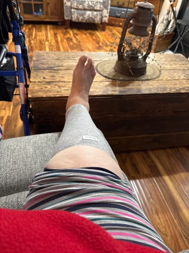 Customer photo review of Premium Bamboo Anti-Fatigue Calf Sleeve