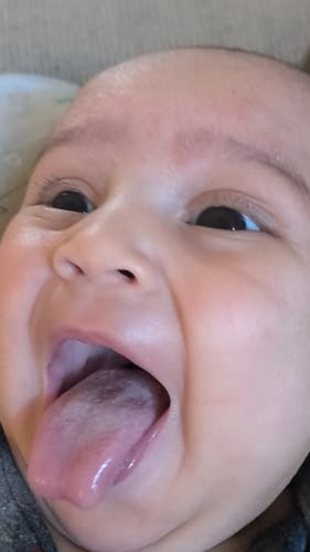 Customer photo review of All Over Ointment Eczema Treatment