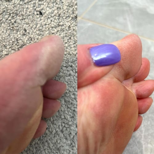 Customer photo review of Fungal Freedom