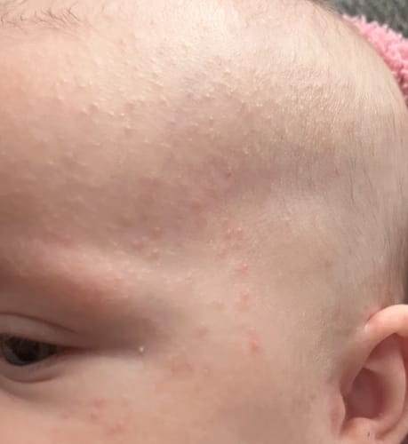 Customer photo review of All Over Ointment Original