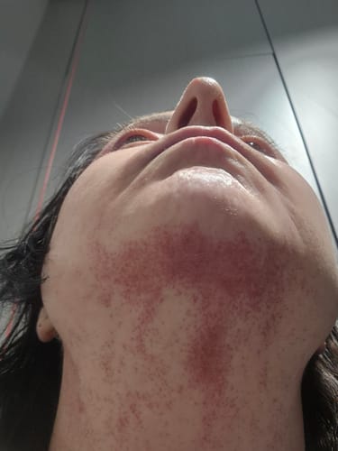 Customer photo review of Calm Balm