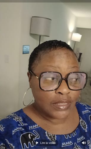 Customer photo review of Hyperpigmentations face cream/Crème de visage anti tâche et phare Kit (2 Pcs)