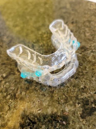 Customer photo review of Dental Impression Trays
