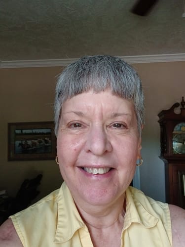 Customer photo review of 3 Month Supply - Deep Collagen Cream