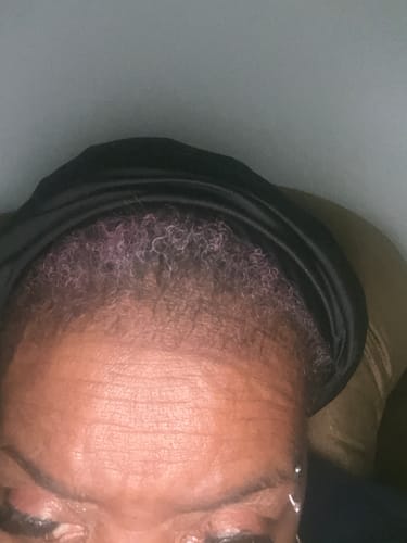 Customer photo review of Rennora Hair Growth Serum