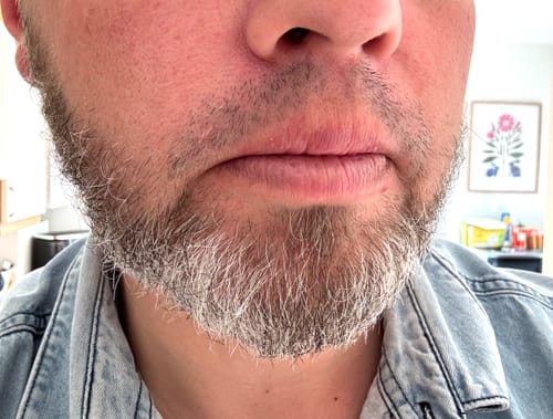 Customer photo review of Seb Natural Soothing Balm