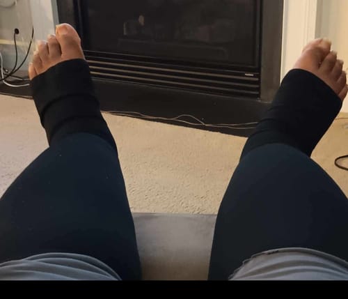 Customer photo review of Beltwell® - Toeless Compression Socks (2 pairs)