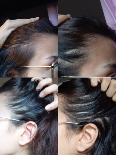 Customer photo review of Vitaminas Hairfy