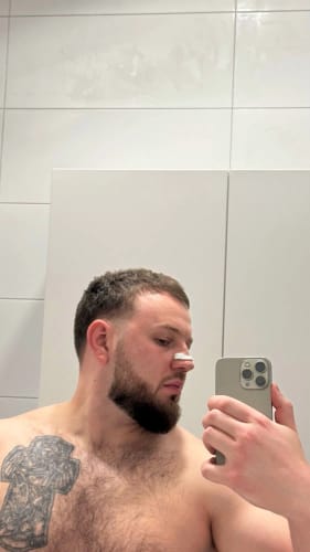 Customer photo review of EasyBreathe Starter Kit