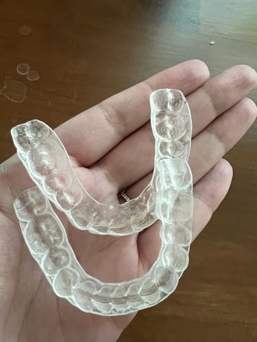 Customer photo review of Dental PRO
