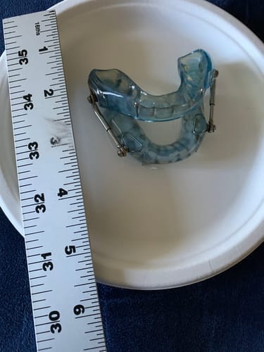 Customer photo review of Dental PRO