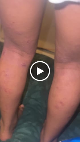 Customer video review of Honey Turmeric + Skin Relief Shower Oil