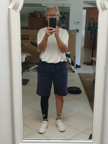 Customer photo review of Summer Compression Sleeves V2 for Knees and Legs