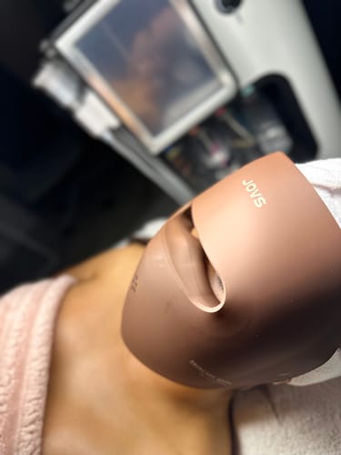Customer photo review of JOVS Led Light Therapy Face Mask
