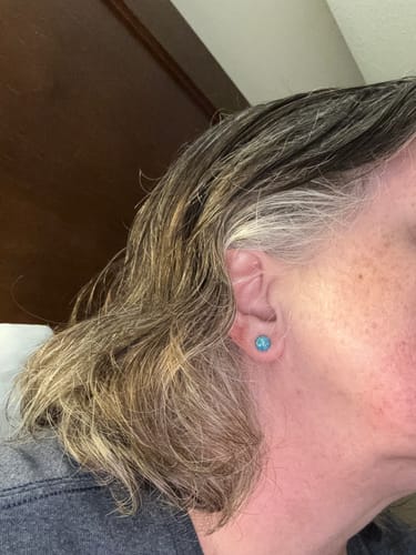 Tammy L. review of Gold Fleck Button 8mm Studs Hypoallergenic Earrings for Sensitive Ears Made with Plastic Posts image 1 out of 1