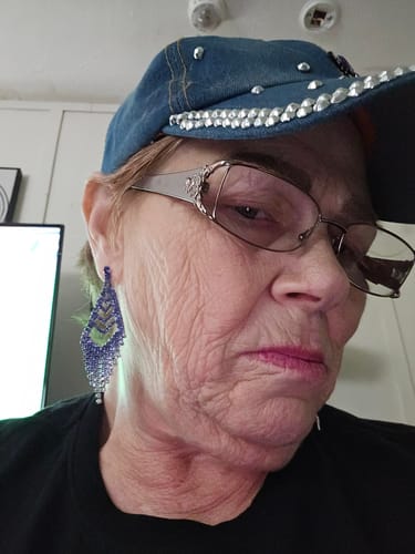 Customer photo review of Glov Micro Infusion System