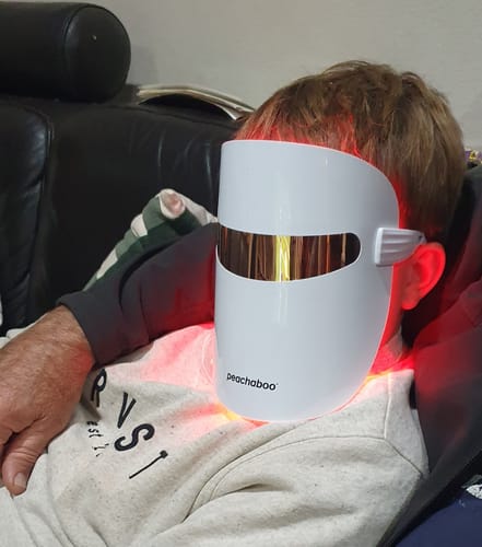 Customer photo review of Peachaboo Glo LED Light Therapy Mask