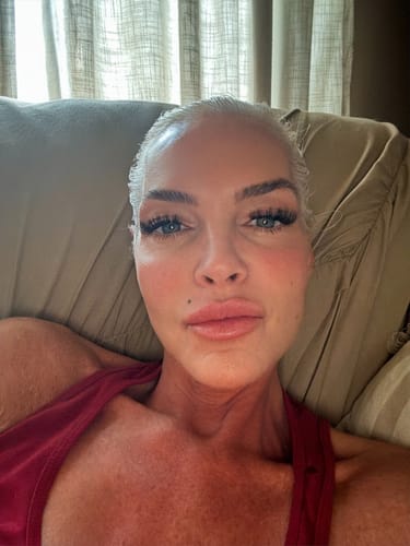 Customer photo review of LipFix: Filler