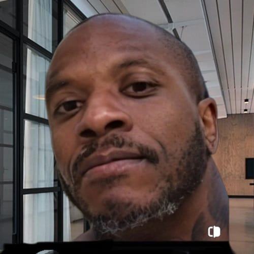 Customer photo review of 12.5% Minoxidil Extra Strength Topical Solution USP for Men.