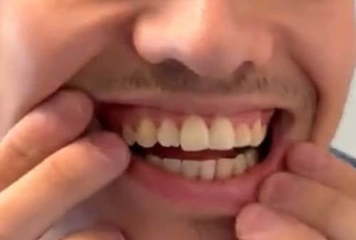 Customer photo review of Smile360 - Brosse à dent automatique