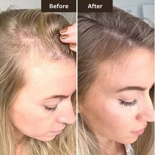 Customer photo review of RootHaven™ Luxury Scalp Treatment At Home
