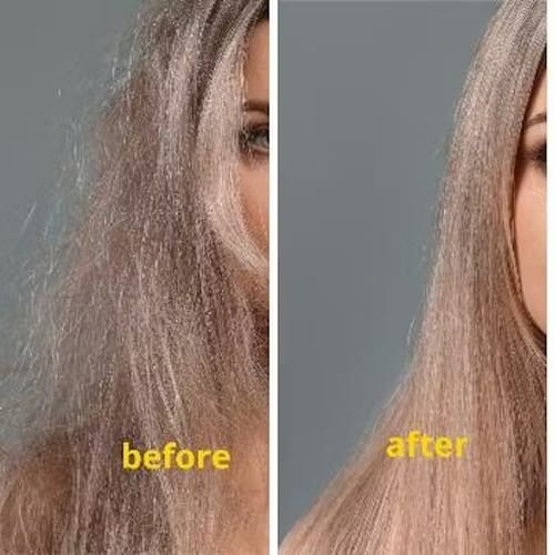 Customer photo review of RootHaven™ Luxury Scalp Treatment At Home