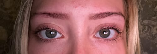 Customer photo review of NEW AND IMPROVED Lash Growth Serum