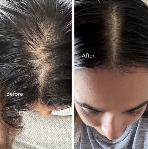 Customer photo review of RootHaven™ Luxury Scalp Treatment At Home