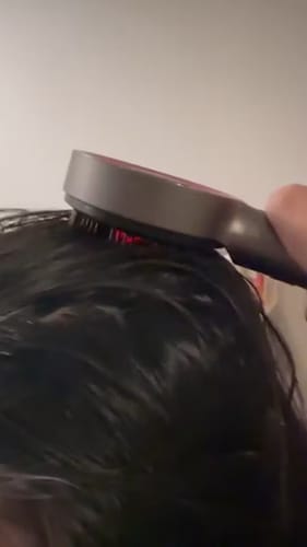 Customer photo review of RootHaven™ Luxury Scalp Treatment At Home