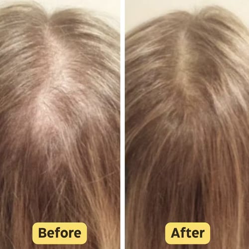 Customer photo review of RootHaven™ Luxury Scalp Treatment At Home