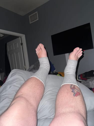 Customer photo review of Elite Bamboo Soothing Footsleeves- 50% OFF